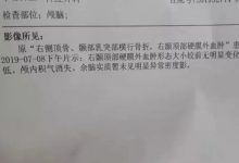 案例分享：車禍導致面癱調理案例-七不姜 生姜養生網-明德CSA生態姜園&明安農業