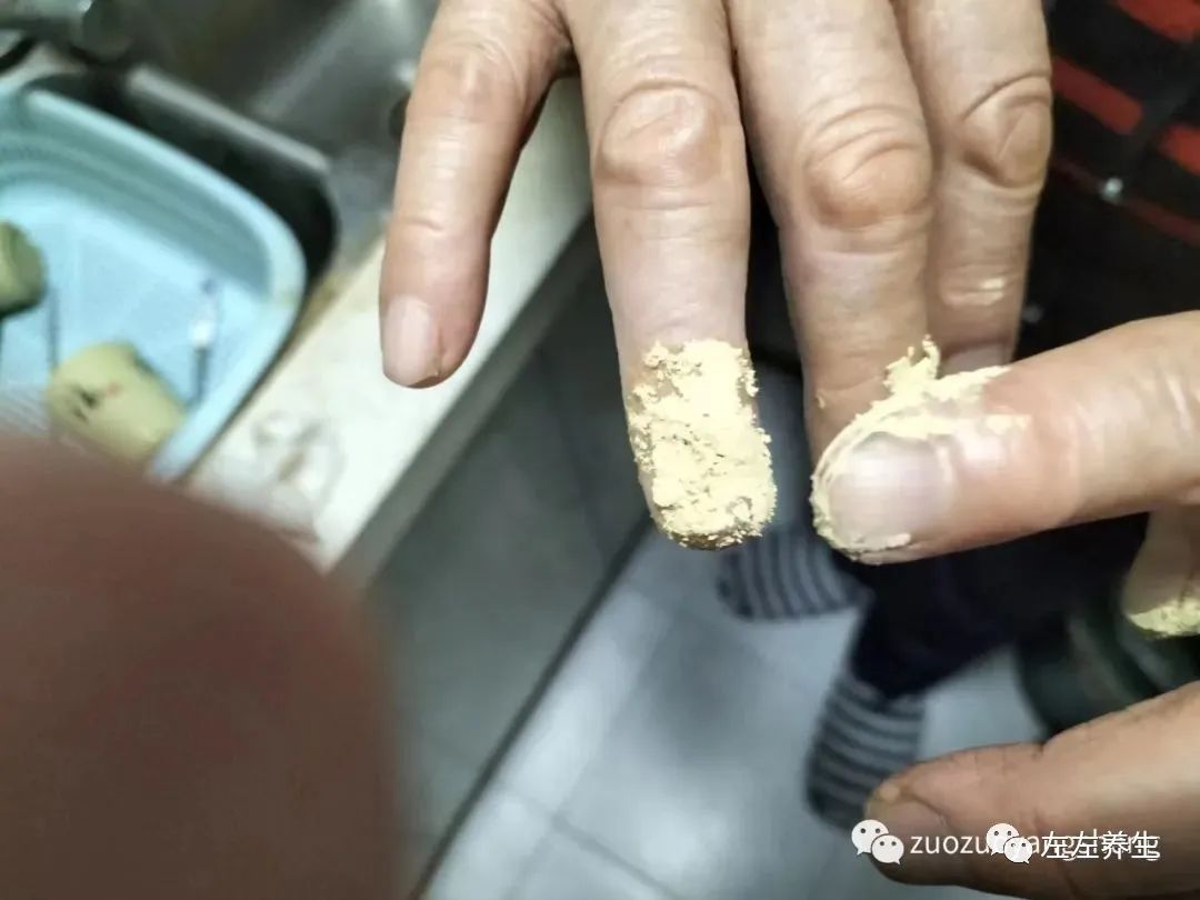 案例分享：手指夾傷后血流不止調理案例