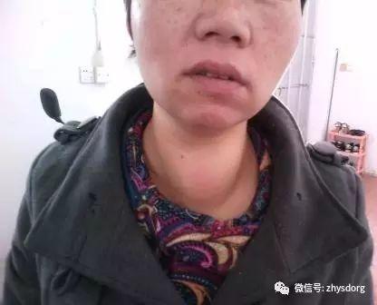 兩個腫瘤案例對比背后的深思