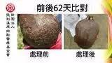 頭部感染案例(辛巴威小女孩探訪)-七不姜 生姜養生網-明德CSA生態姜園&明安農業
