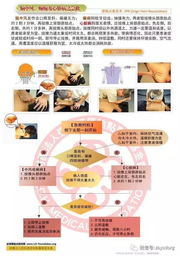 腦中風、癲癇、心臟病之院前急救。原始點復蘇術 OPR (Origin Point Resuscitation)