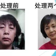 肺炎吐血案例-七不姜 生姜養生網-明德CSA生態姜園&明安農業