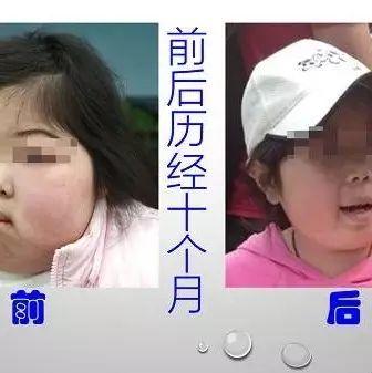 腎病癥候群案例（簡體版）-七不姜 生姜養生網-明德CSA生態姜園&明安農業