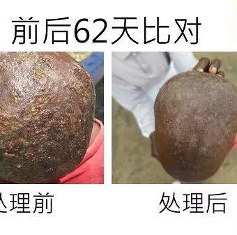 頭部感染案例（辛巴威小女孩探訪）（簡體版）-七不姜 生姜養生網-明德CSA生態姜園&明安農業