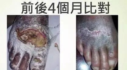 毒蛇咬傷如何處理-2017.1太原講座剪輯-七不姜 生姜養生網-明德CSA生態姜園&明安農業