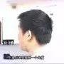 全身24小時癢案例(簡體版)-七不姜 生姜養生網-明德CSA生態姜園&明安農業