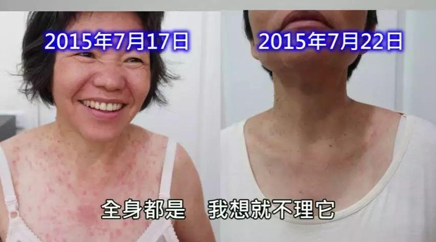 營養食品中毒案例-七不姜 生姜養生網-明德CSA生態姜園&明安農業