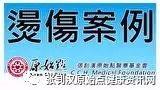 燙傷案例(休士頓)-七不姜 生姜養生網-明德CSA生態姜園&明安農業