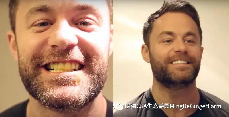 美牙神器-七不姜 生姜養生網-明德CSA生態姜園&明安農業