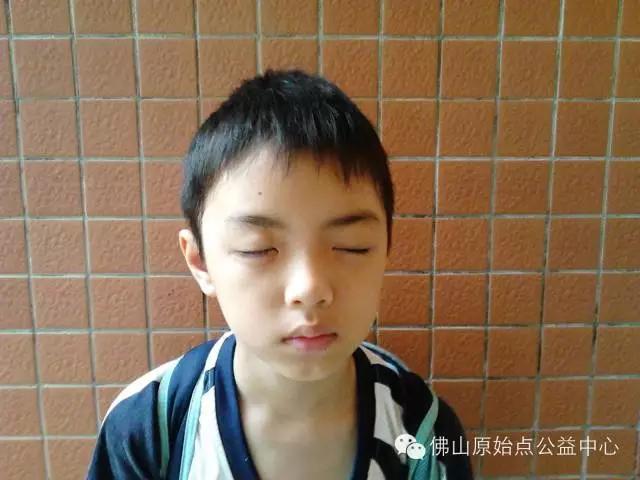 用原始點理療病毒性腦炎后遺癥三個月好了一大半