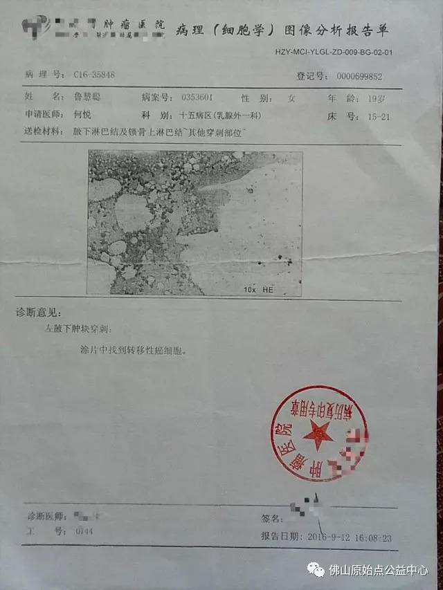 原始點調理乳腺癌案例
