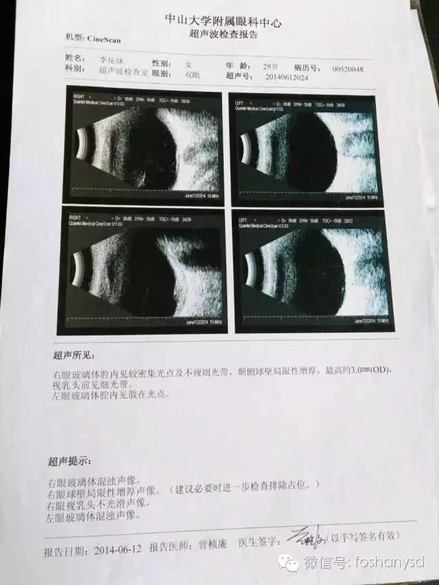 因眼睛問題用原始點調理身體一個多月，意外減肥20斤