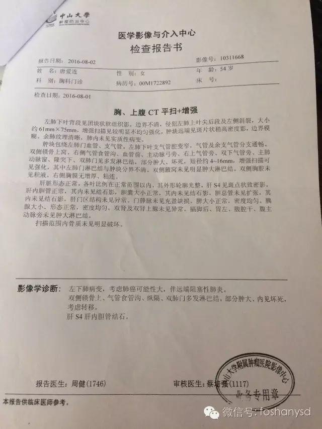 原始點調理肺癌案例：劫后余生