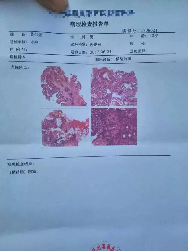 原始點調理結腸癌：不及是缺少，過量是消耗