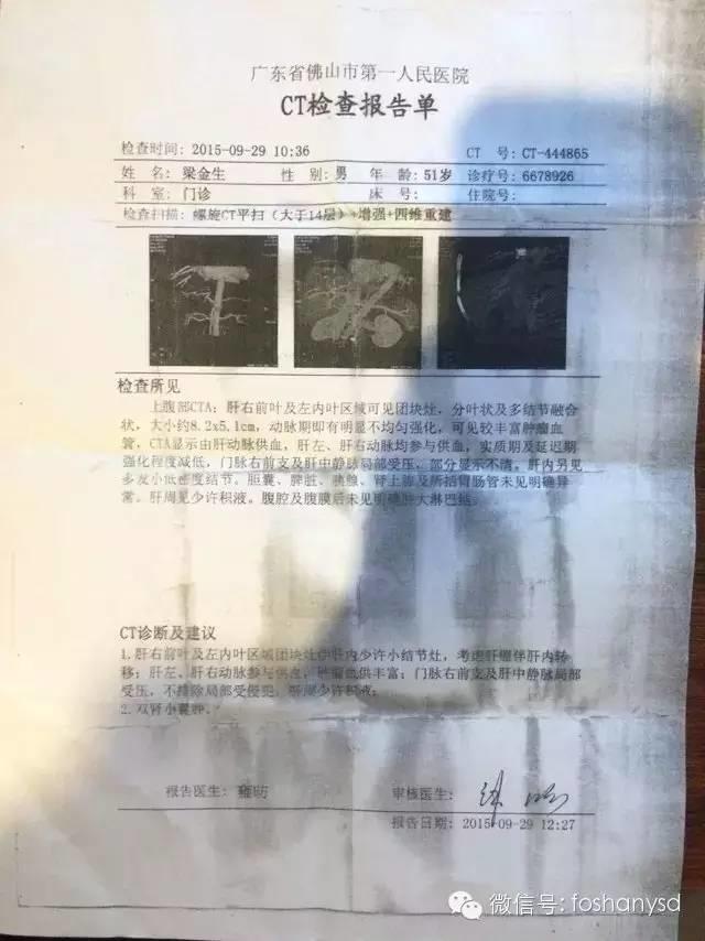 我爸的惡性肝腫瘤用原始點調理54天，基本好了