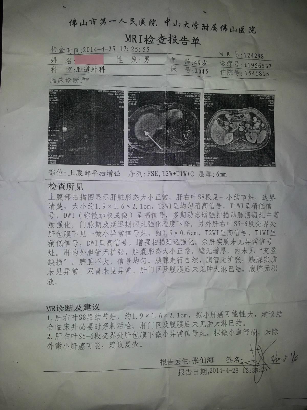 “肝癌”在原始點的呵護下65天康復