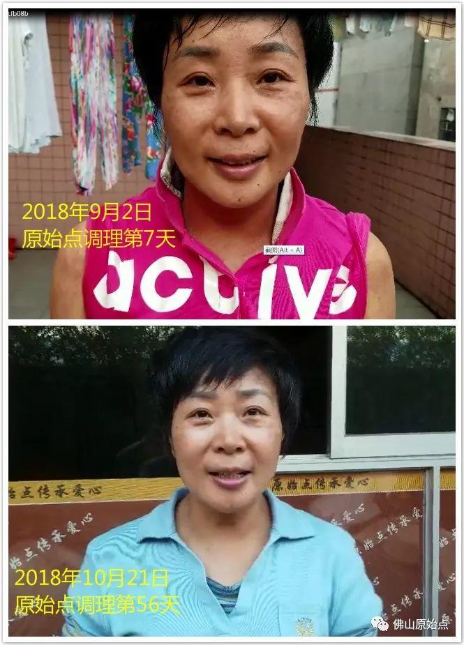 原始點調理嚴重全身濕疹、蕁麻疹:熱源是根本 原始點調理嚴重全身濕疹、蕁麻疹:熱源是根本