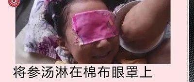 參湯洗眼改善兒童視力案例-七不姜 生姜養生網-明德CSA生態姜園&明安農業