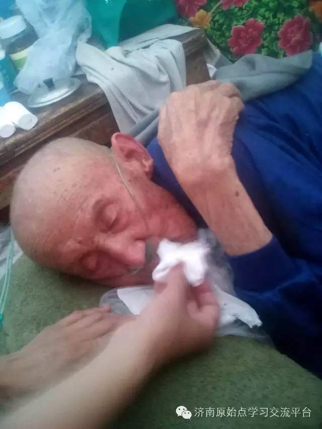 91歲高齡腸梗阻，應用原始點薑湯灌腸，順利康復