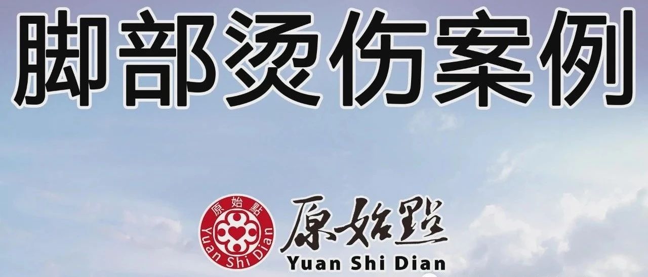 腳部燙傷案例-七不姜 生姜養生網-明德CSA生態姜園&明安農業