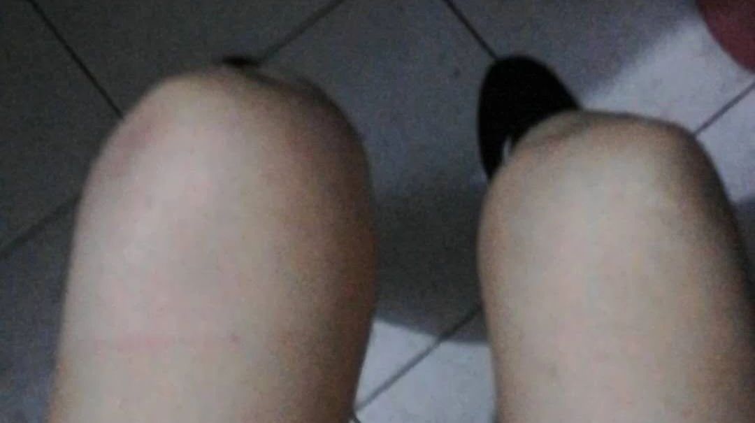 原始點案例:膝蓋腫脹-七不姜 生姜養生網-明德CSA生態姜園&明安農業