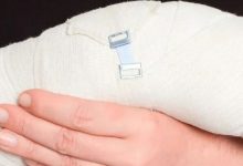 案例分享：撓骨骨折、錯位，調理十天見效的案例-七不姜 生姜養生網-明德CSA生態姜園&明安農業