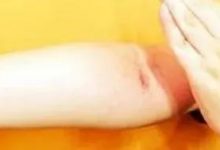 這套拍打沖擊操，立秋后一定要做起來！每天一遍，百病難見！-七不姜 生姜養生網-明德CSA生態姜園&明安農業