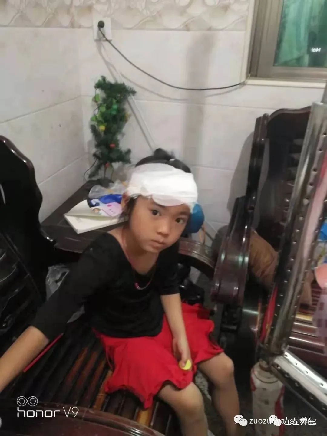 案例分享：小孩毛囊炎反復發作調理案例