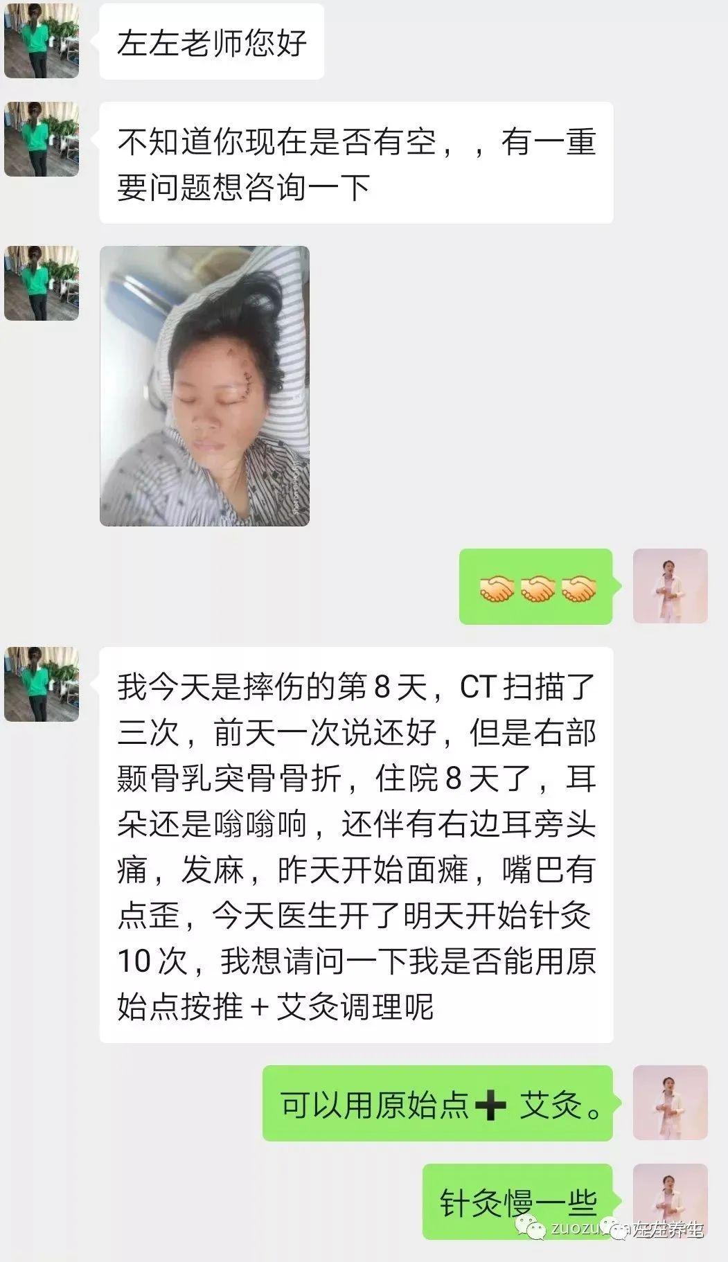 案例分享：車禍導致面癱調理案例
