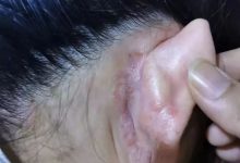 案例分享：不孕，小兒夜啼、奶水不足調理案例-七不姜 生姜養生網-明德CSA生態姜園&明安農業