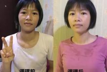 案例分享:學員李女士學習與踐行自然療法的心路歷程-七不姜 生姜養生網-明德CSA生態姜園&明安農業