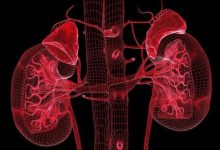 微問答26期：腎衰竭患者配合程度不高怎么辦？-七不姜 生姜養生網-明德CSA生態姜園&明安農業