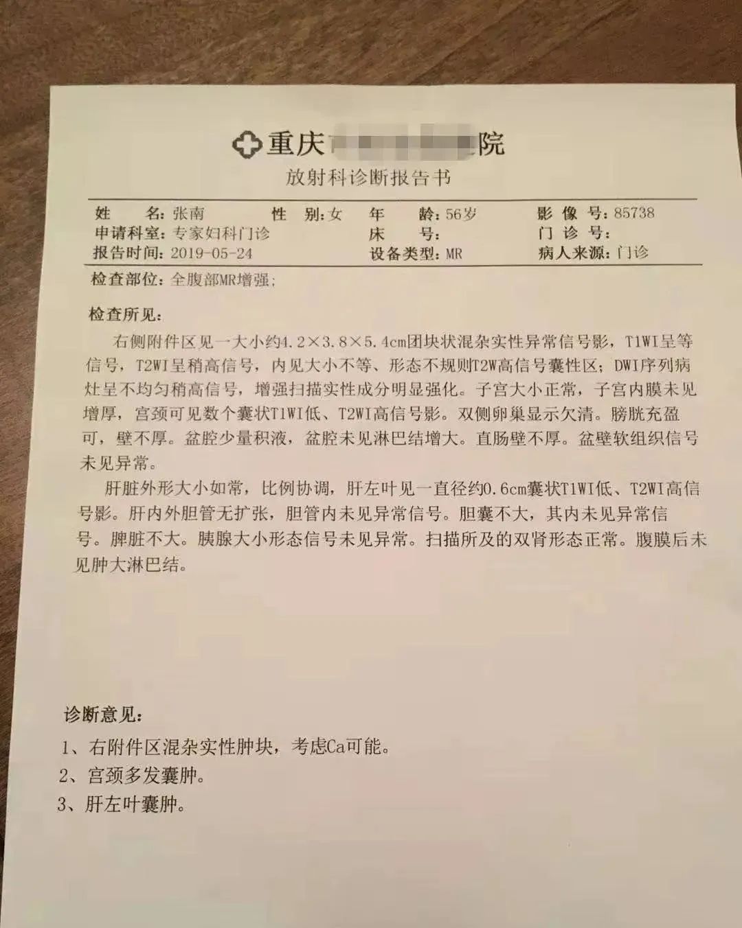 【原始點案例】用原始點調理附件腫瘤案例！