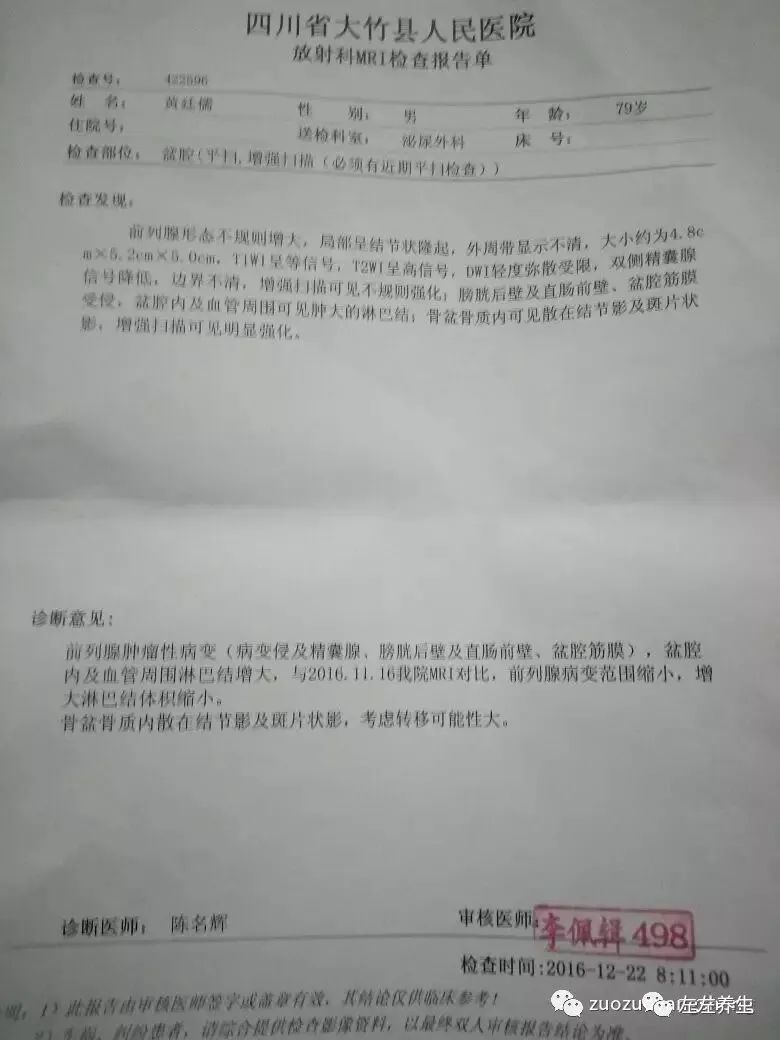 案例分享：前列腺癌的調理案例