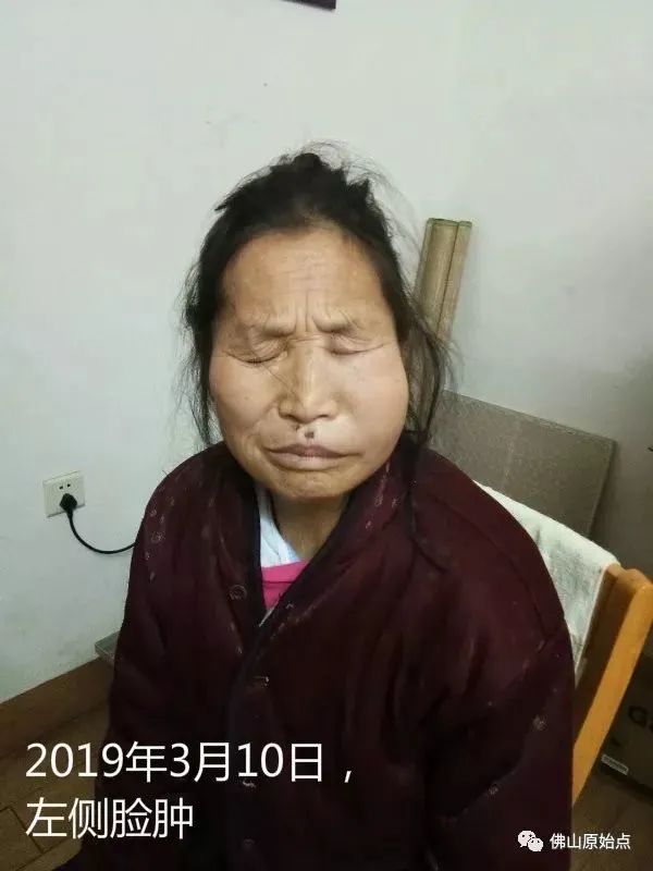 原始點調理牙痛案例