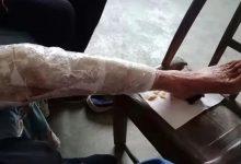 案例分享：85歲老人腿痛、無力，“種”發的案例-七不姜 生姜養生網-明德CSA生態姜園&明安農業