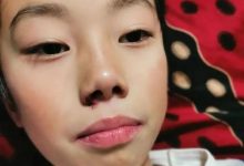 案例分享：兒童淋巴結腫大、腺樣體肥大、張嘴呼吸的案例-七不姜 生姜養生網-明德CSA生態姜園&明安農業