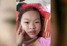 案例分享：兒童十年便秘調理案例-七不姜 生姜養生網-明德CSA生態姜園&明安農業