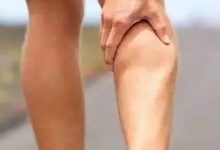 案例分享：腿痛麻木、無力調理案例-七不姜 生姜養生網-明德CSA生態姜園&明安農業