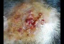 案例分享：小孩毛囊炎反復發作調理案例-七不姜 生姜養生網-明德CSA生態姜園&明安農業