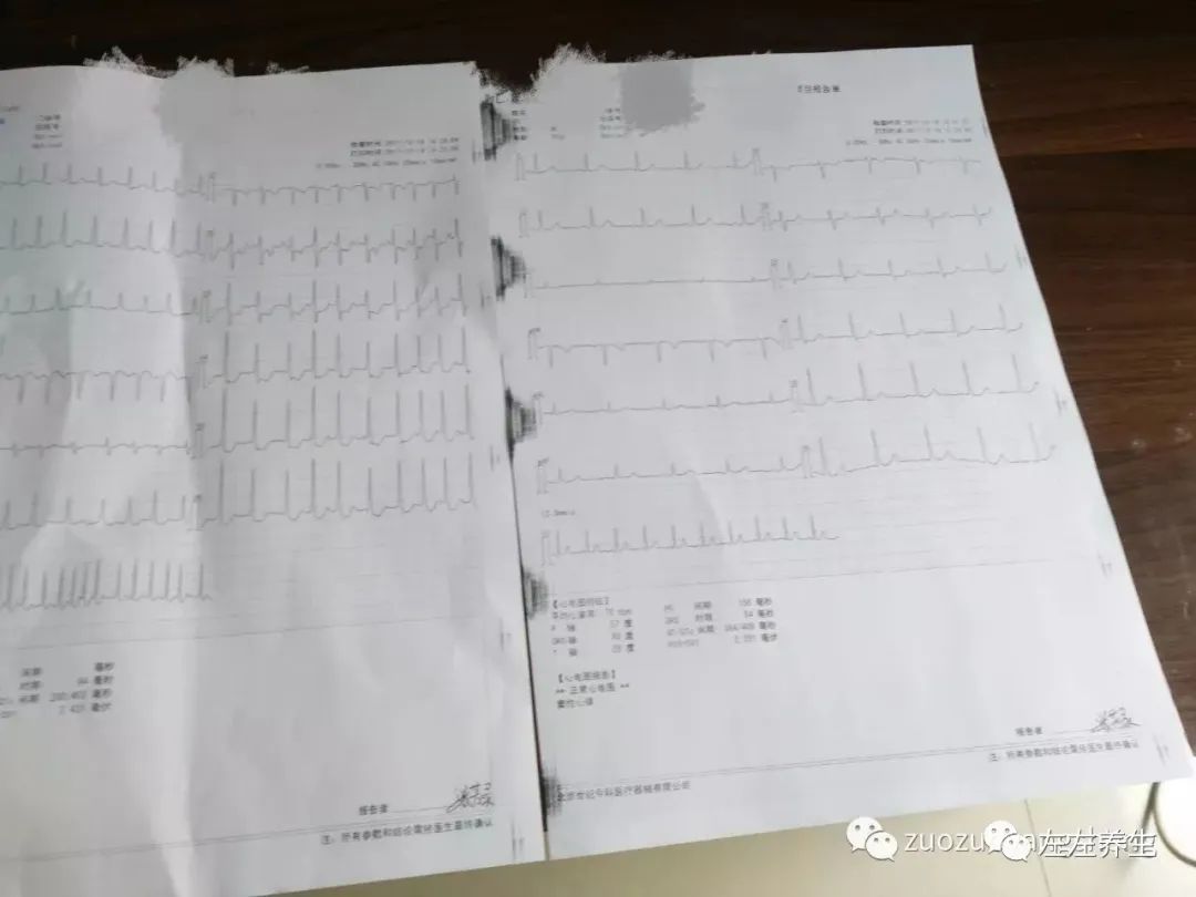 案例分享：70歲老人突感心慌、胸悶、呼吸困難急救案例