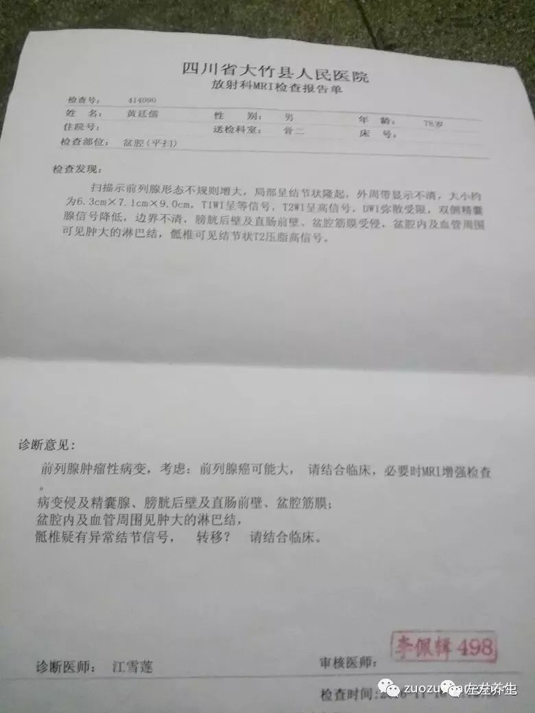 案例分享：前列腺癌的調理案例