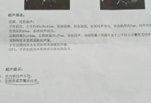 案例分享：多囊卵巢綜合征與月經長達三個月的案例-七不姜 生姜養生網-明德CSA生態姜園&明安農業