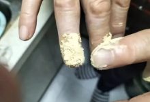 案例分享：手指夾傷后血流不止調理案例-七不姜 生姜養生網-明德CSA生態姜園&明安農業