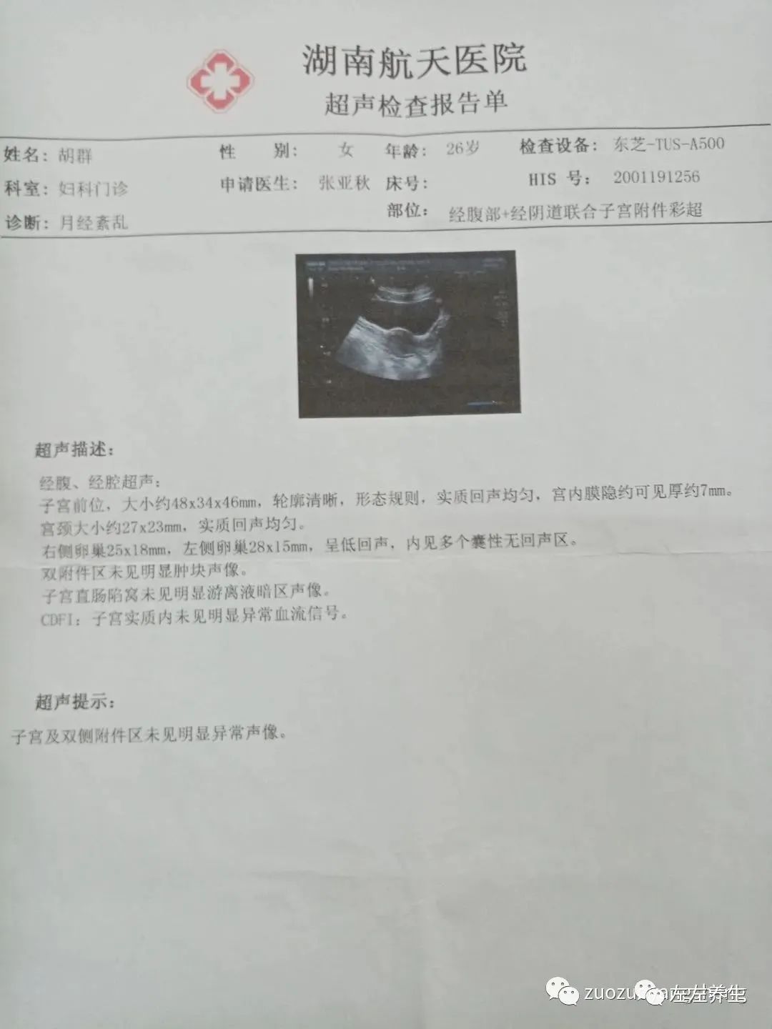 案例分享：多囊卵巢綜合征與月經長達三個月的案例