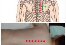 最好的急救方法趕緊學起來吧-七不姜 生姜養生網-明德CSA生態姜園&明安農業