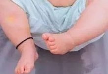 案例分享：小孩尿床的調理案例-七不姜 生姜養生網-明德CSA生態姜園&明安農業