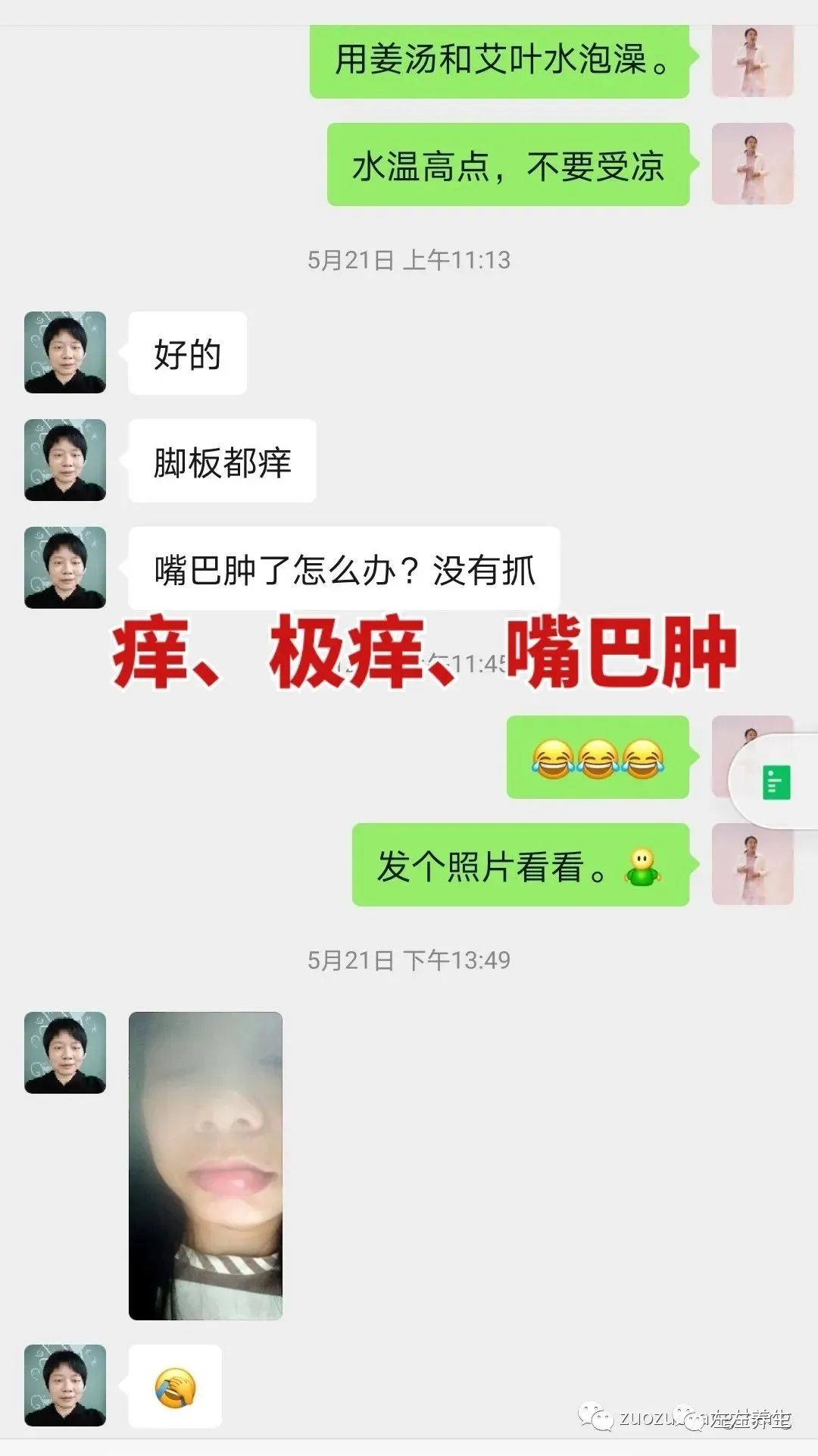 案例分享：調理蕁麻疹的好轉反應