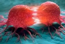 微問答10期：姑姑得了乳腺癌，老公卻見死不救？-七不姜 生姜養生網-明德CSA生態姜園&明安農業