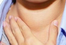 微問答23期：16歲小孩得了甲亢，對人愛理不理，經常發脾氣-七不姜 生姜養生網-明德CSA生態姜園&明安農業